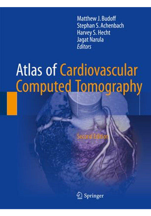 Atlas of Cardiovascular Computed Tomography 2nd Ed