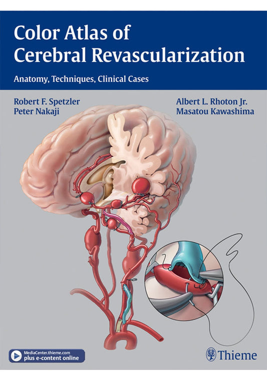 Color Atlas of Cerebral Revascularization: Anatomy, Techniques, Clinical Cases 1st Edition