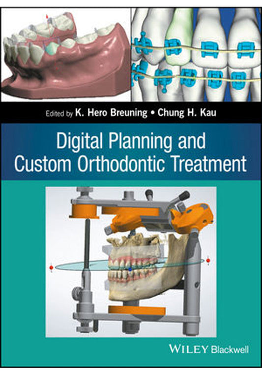 Digital Planning and Custom Orthodontic Treatment