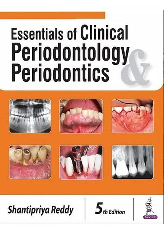 Essentials of Clinical Periodontology Periodontics