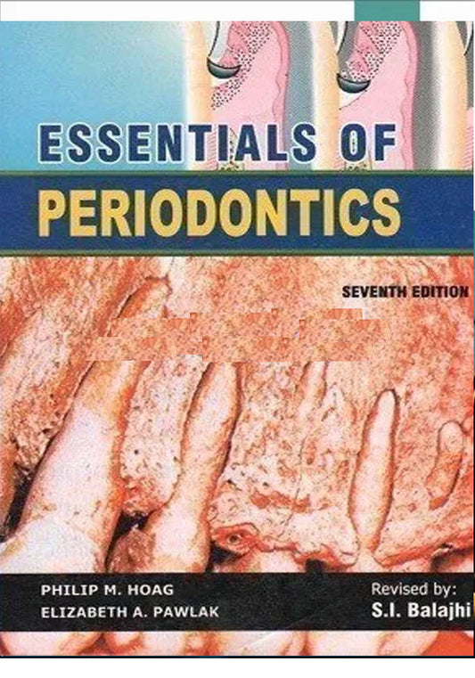 ESSENTIALS OF PERIODONTICS