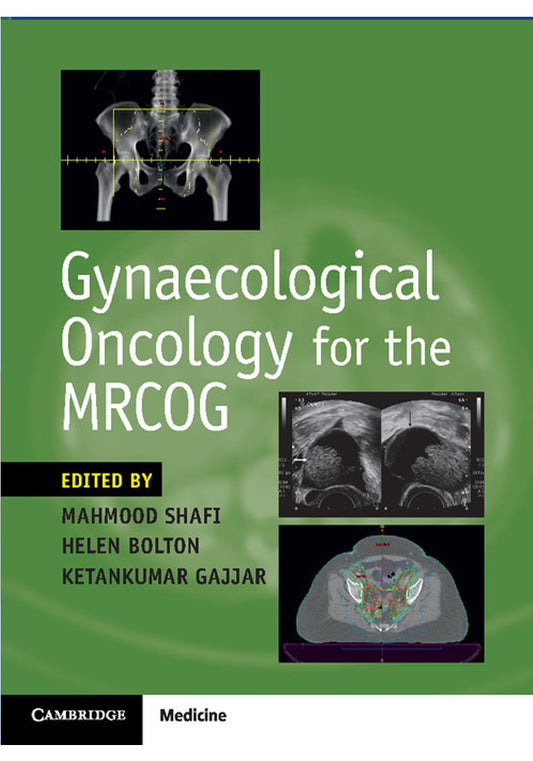Gynaecological Oncology for the MRCOG
