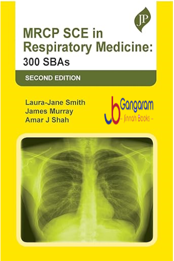 MRCP SCE in Respiratory Medicine: 300 SBAs 2nd Edition