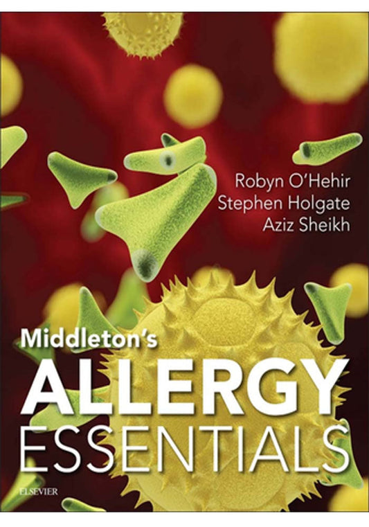 Middleton's Allergy Essentials 1st Edition