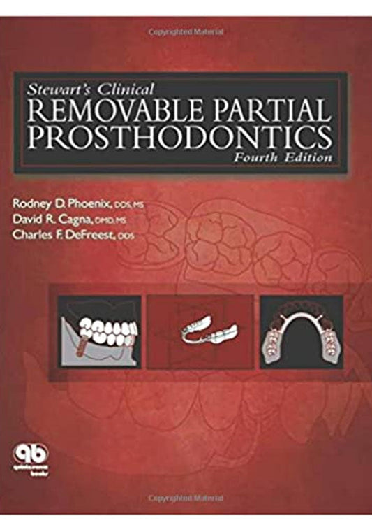 Stewart's Clinical Removable Partial Prosthodontics