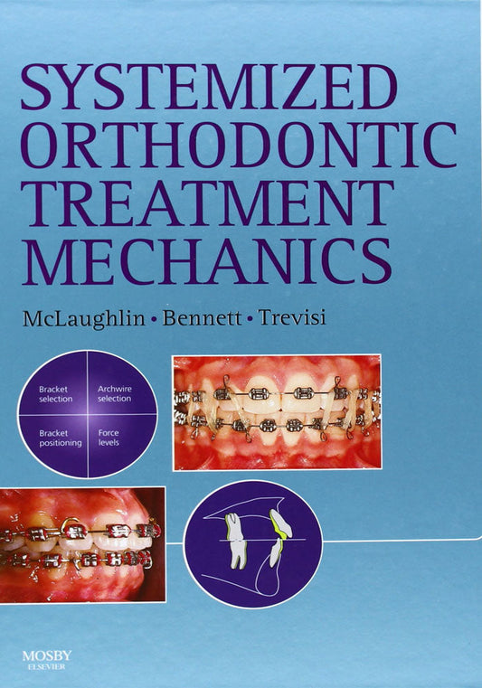 Systemized Orthodontic Treatment Mechanics