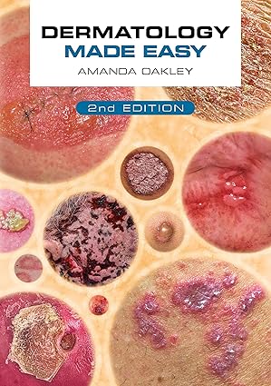 Dermatology Made Easy, second edition