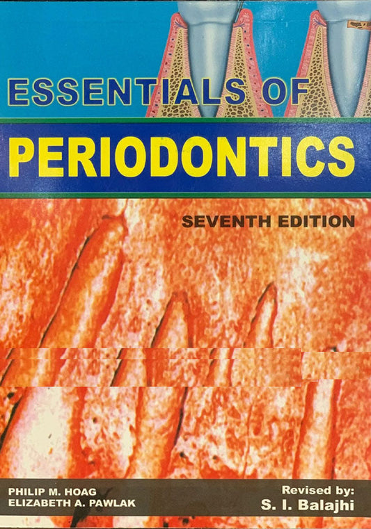 ESSENTIALS OF PERIODONTICS
