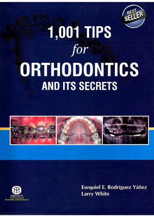 1001 Tips for Orthodontics and its Secrets