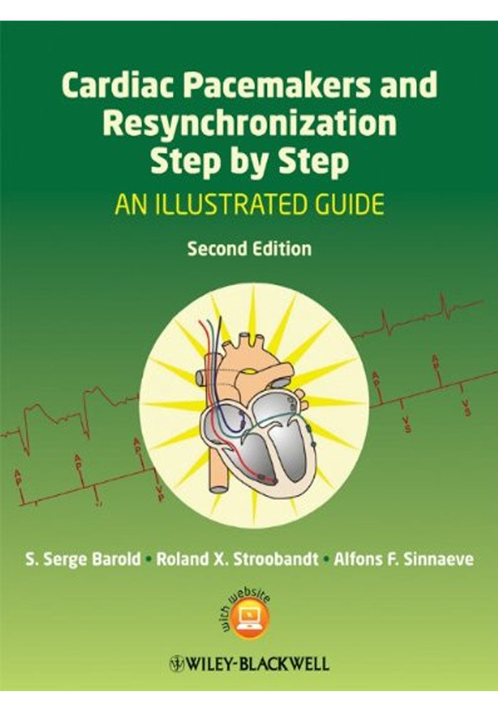 Cardiac Resynchronization Pacemaker Cardiac Pacemakers and Resynchronization Step by Step An Illustrated G ...
