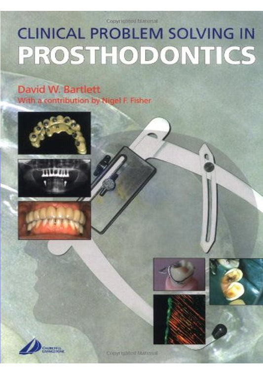 Clinical Problem Solving in Prosthodontics 1st Edition