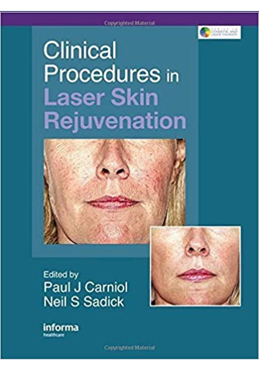 Clinical Procedures in Laser Skin Rejuvenation