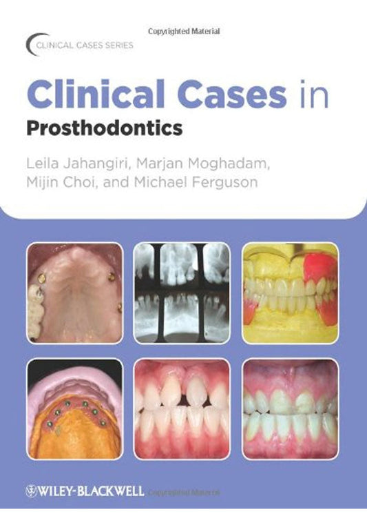 Clinical Cases in Prosthodontics