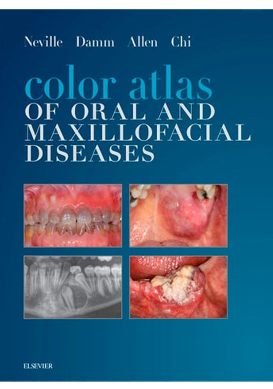 Color Atlas of Oral and Maxillofacial Diseases 1st Edition