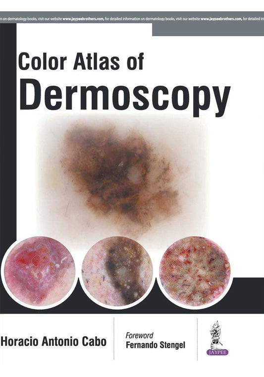 Colour Atlas of Dermoscopy