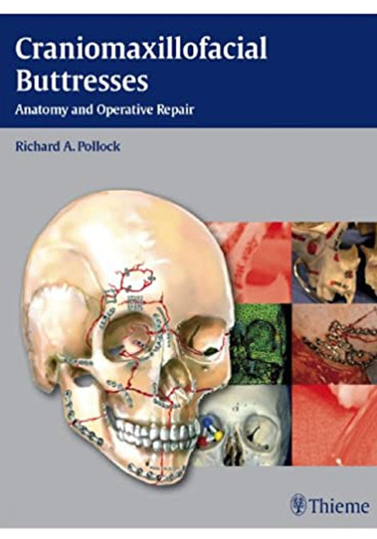 Craniomaxillofacial Buttresses: Anatomy and Operative Repair 1st Edition, Kindle Edition