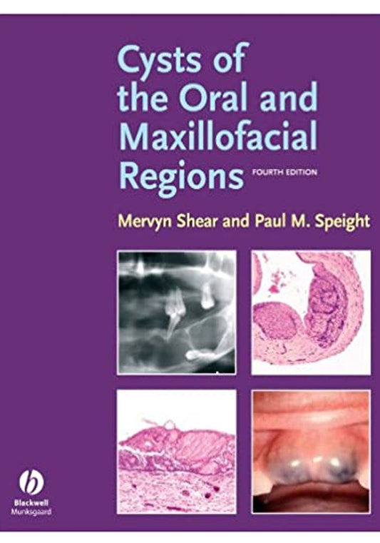 Cysts of the Oral and Maxillofacial Regions 4th Edition