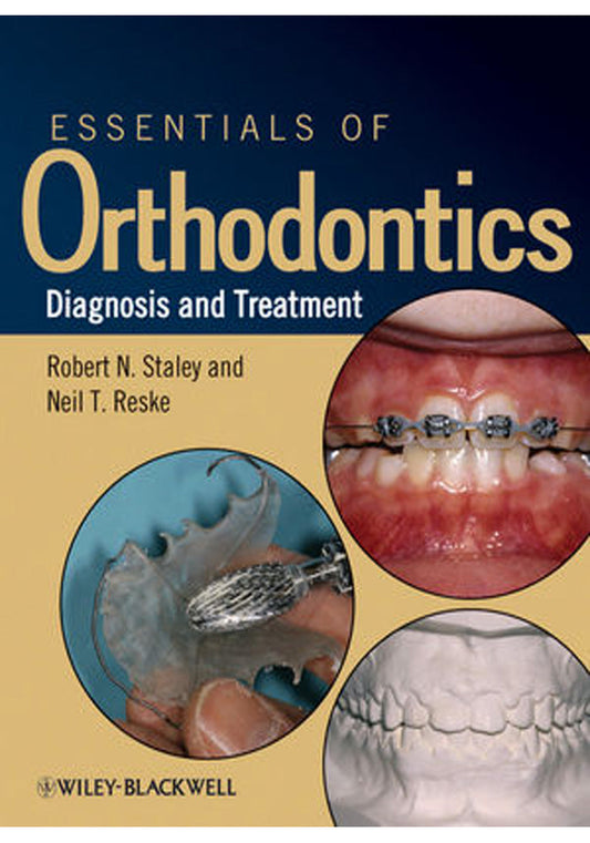 Essentials of Orthodontics Diagnosis and Treatment