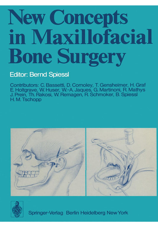 New Concepts in Maxillofacial Bone Surgery Kindle Edition